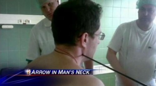 arrow in the neck.jpg